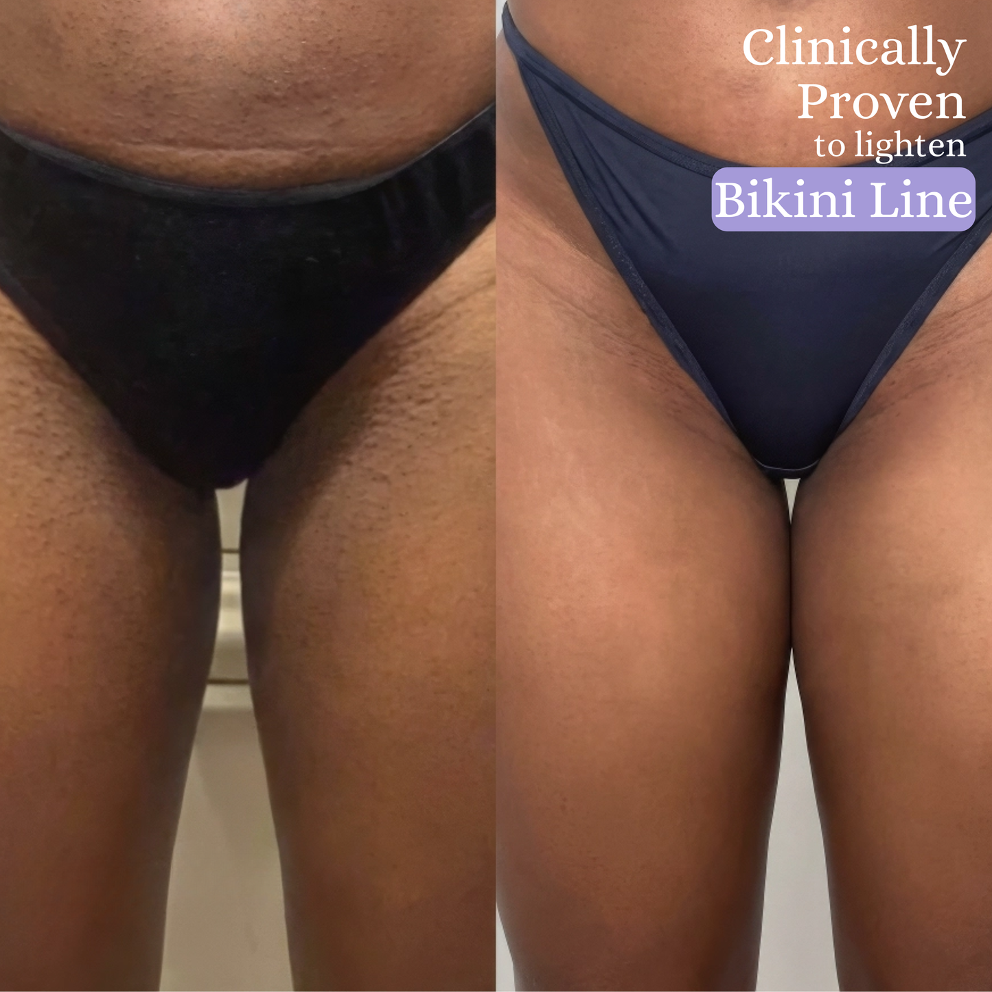 Tisella Even Tone Stick